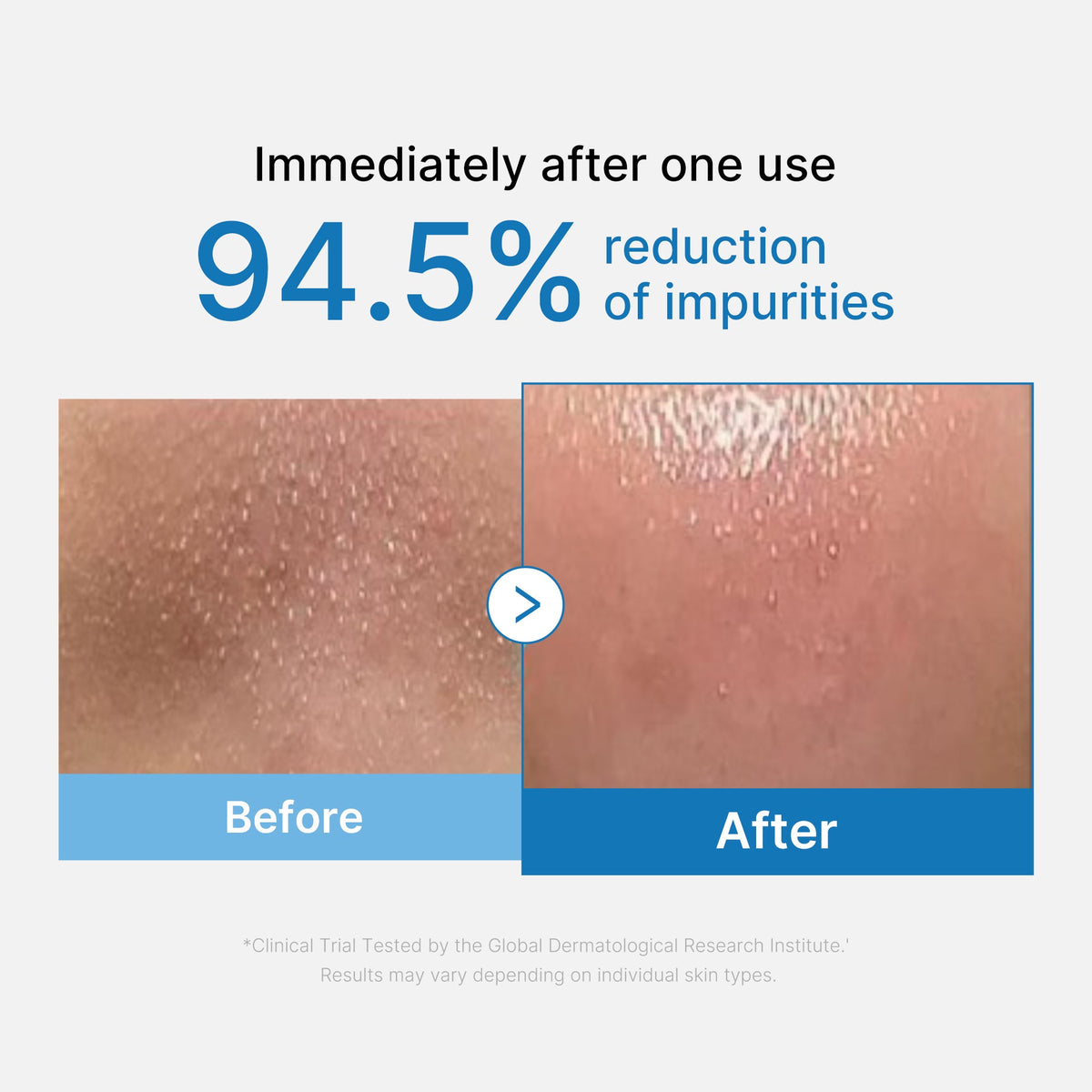 Zero Pore Blackhead Deep Cleansing Oil C1