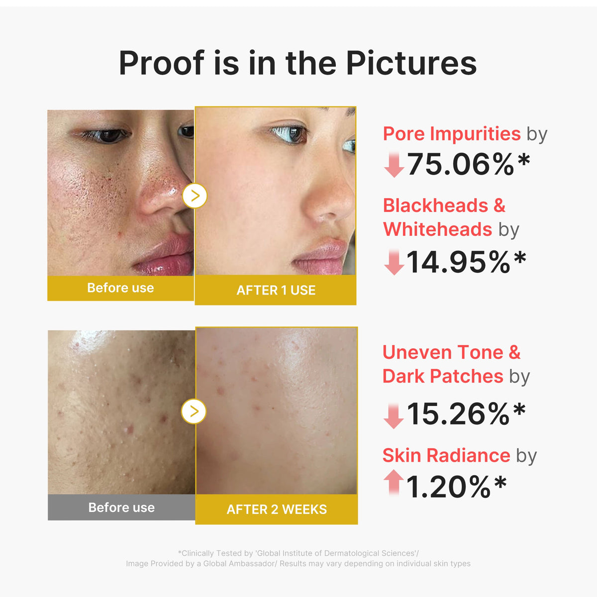 Kojic Acid Turmeric Peel Shot S0