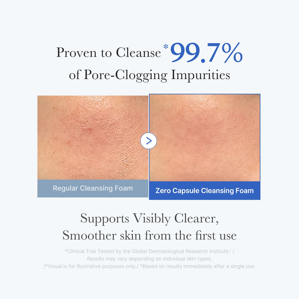 Zero Pore Capsule Cleansing Foam H4