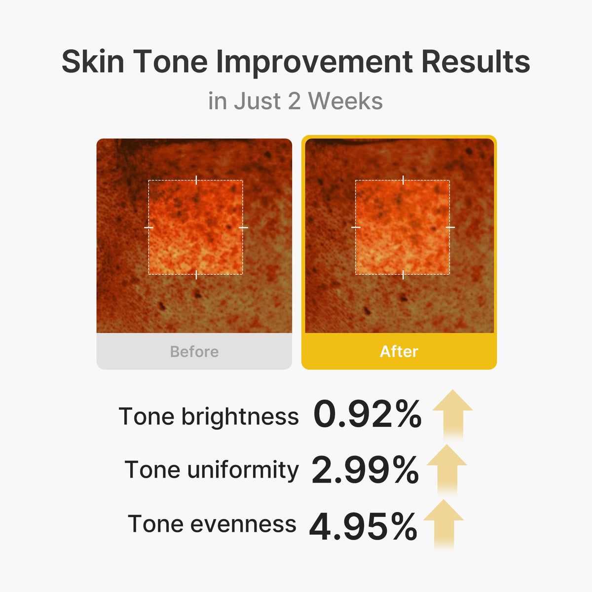 Kojic Acid Turmeric Vita Capsule Cream D0