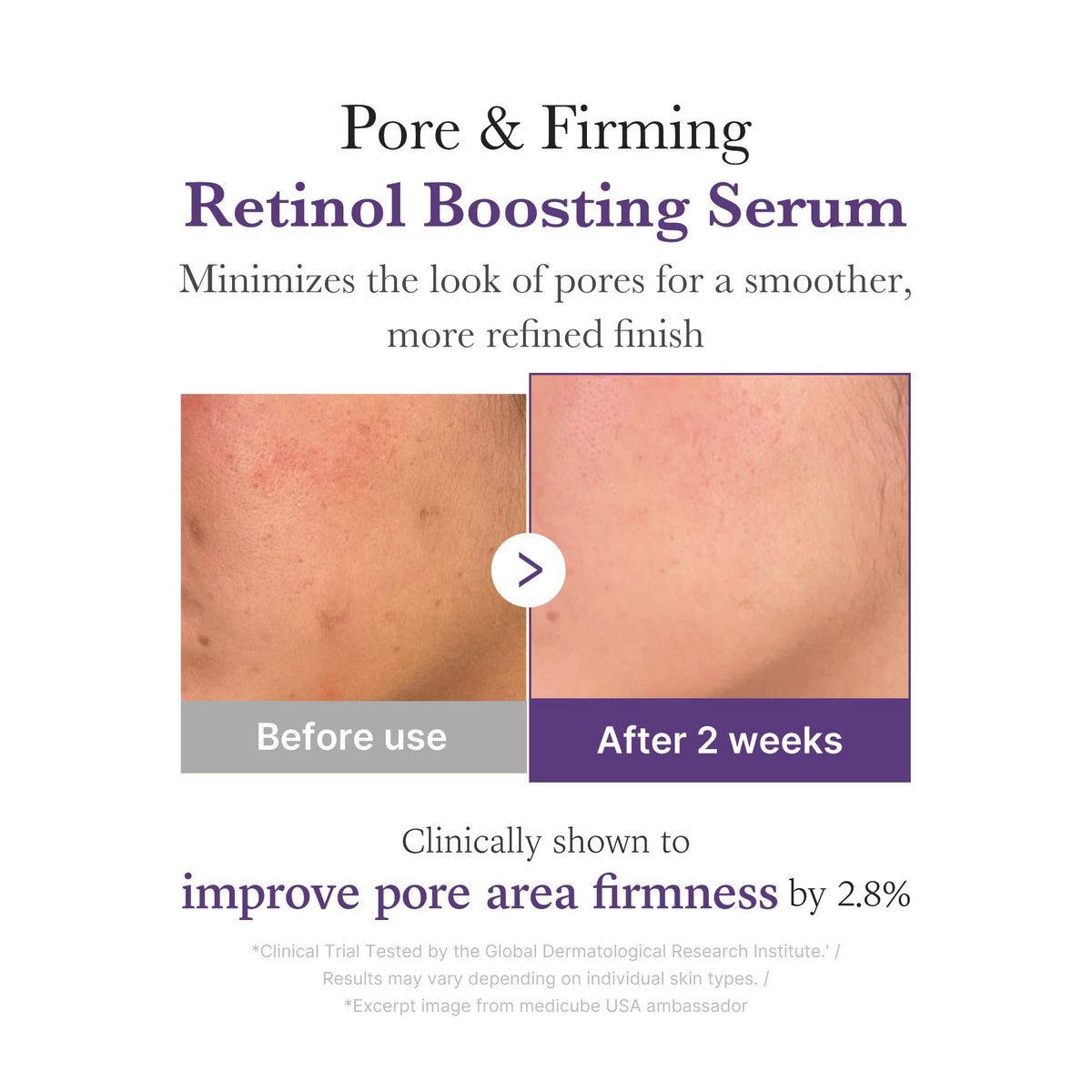 Retinol NMN Boosting Serum I6