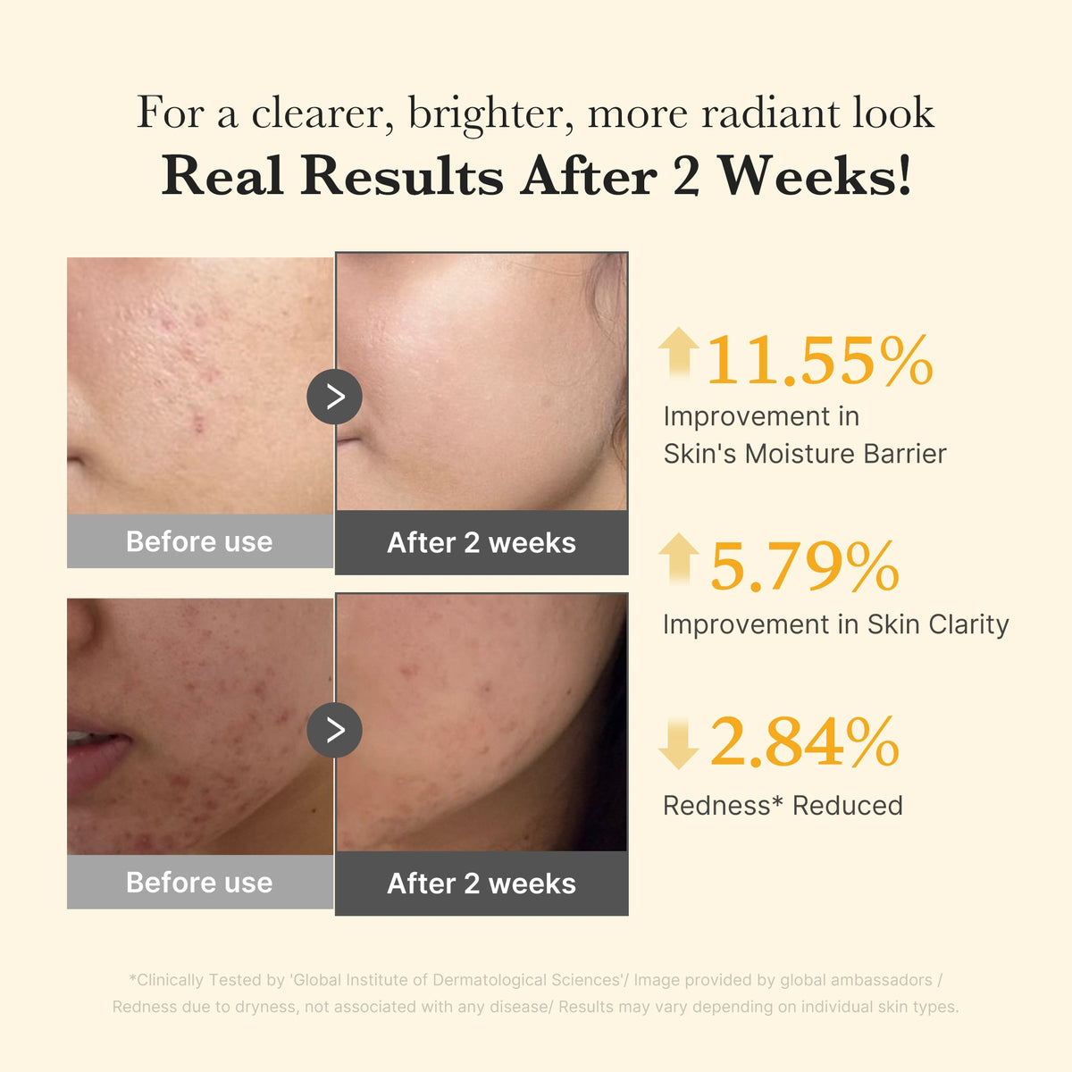 Kojic Acid Turmeric Capsule Serum H7