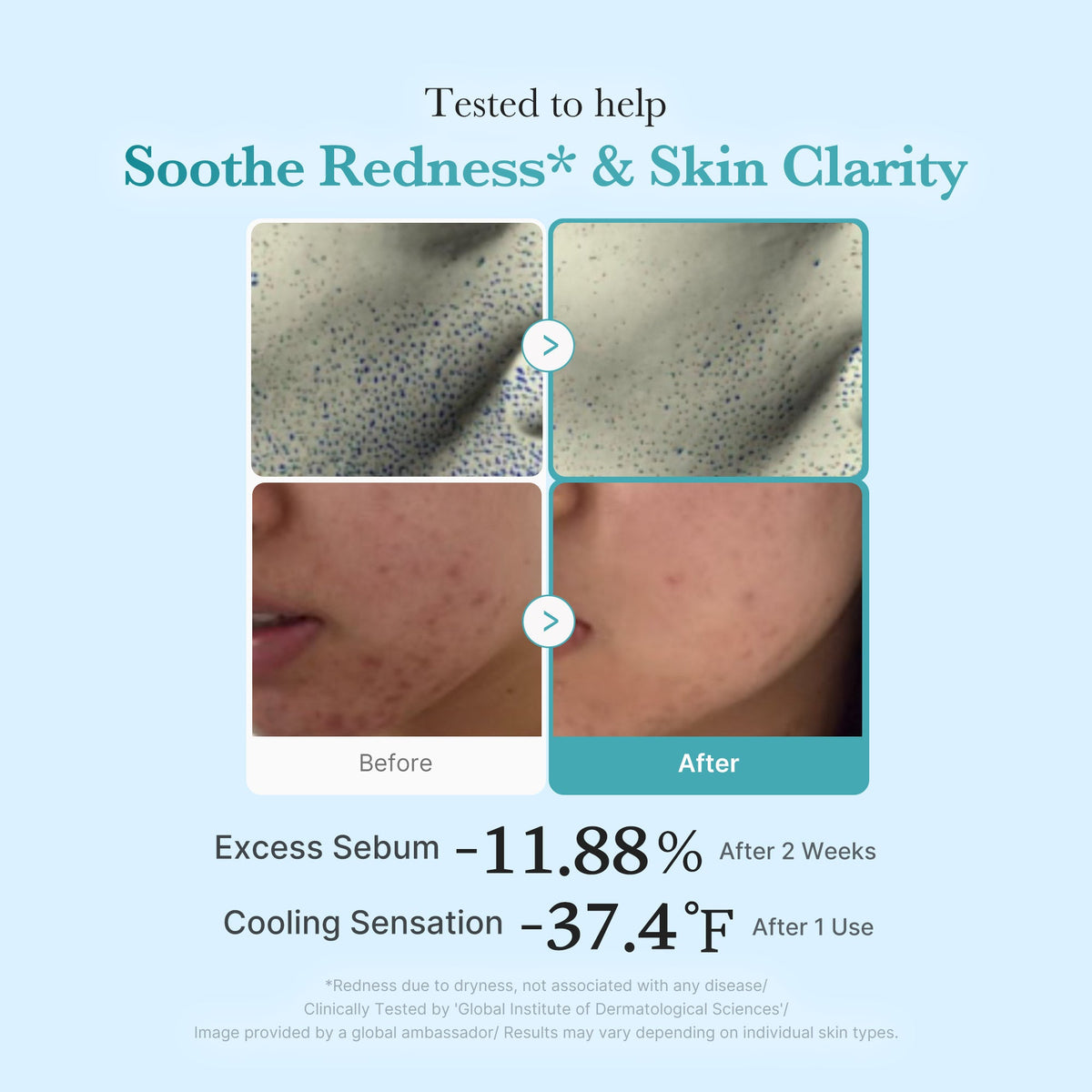 Azelaic Acid Niacinamide Clarifying Toner U5