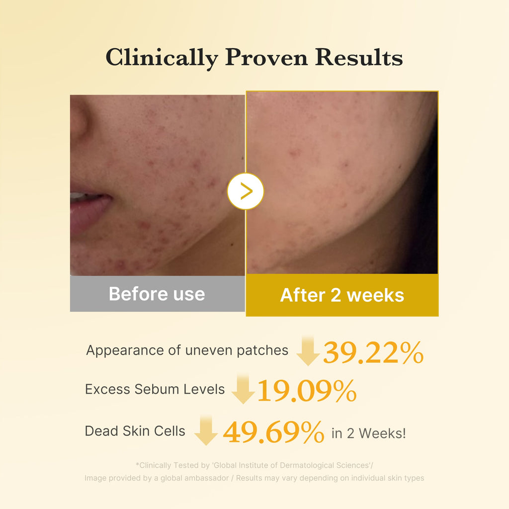 Kojic Acid Tumeric Toner Pad P5