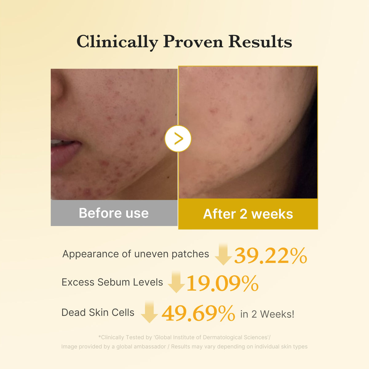 Kojic Acid Tumeric Toner Pad P5