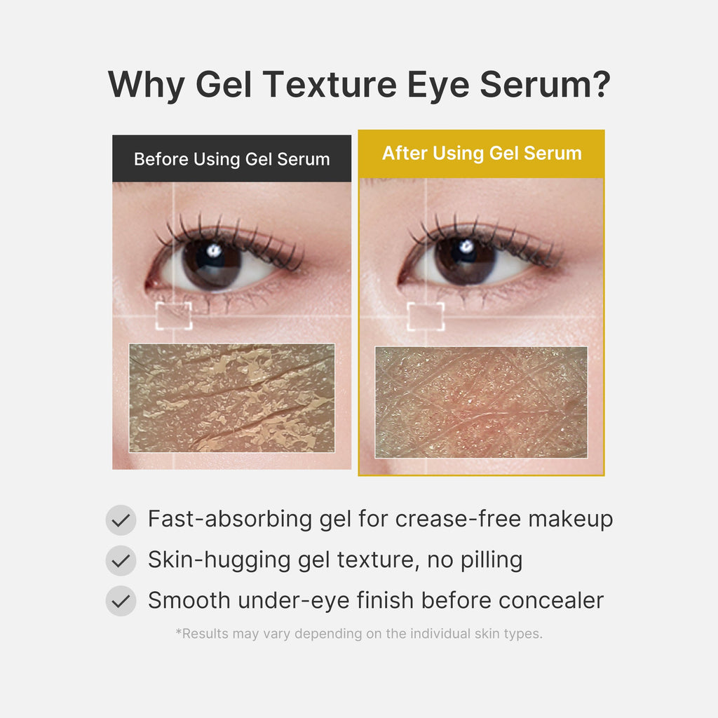 Kojic Acid Tumeric Eye Gel Serum W4