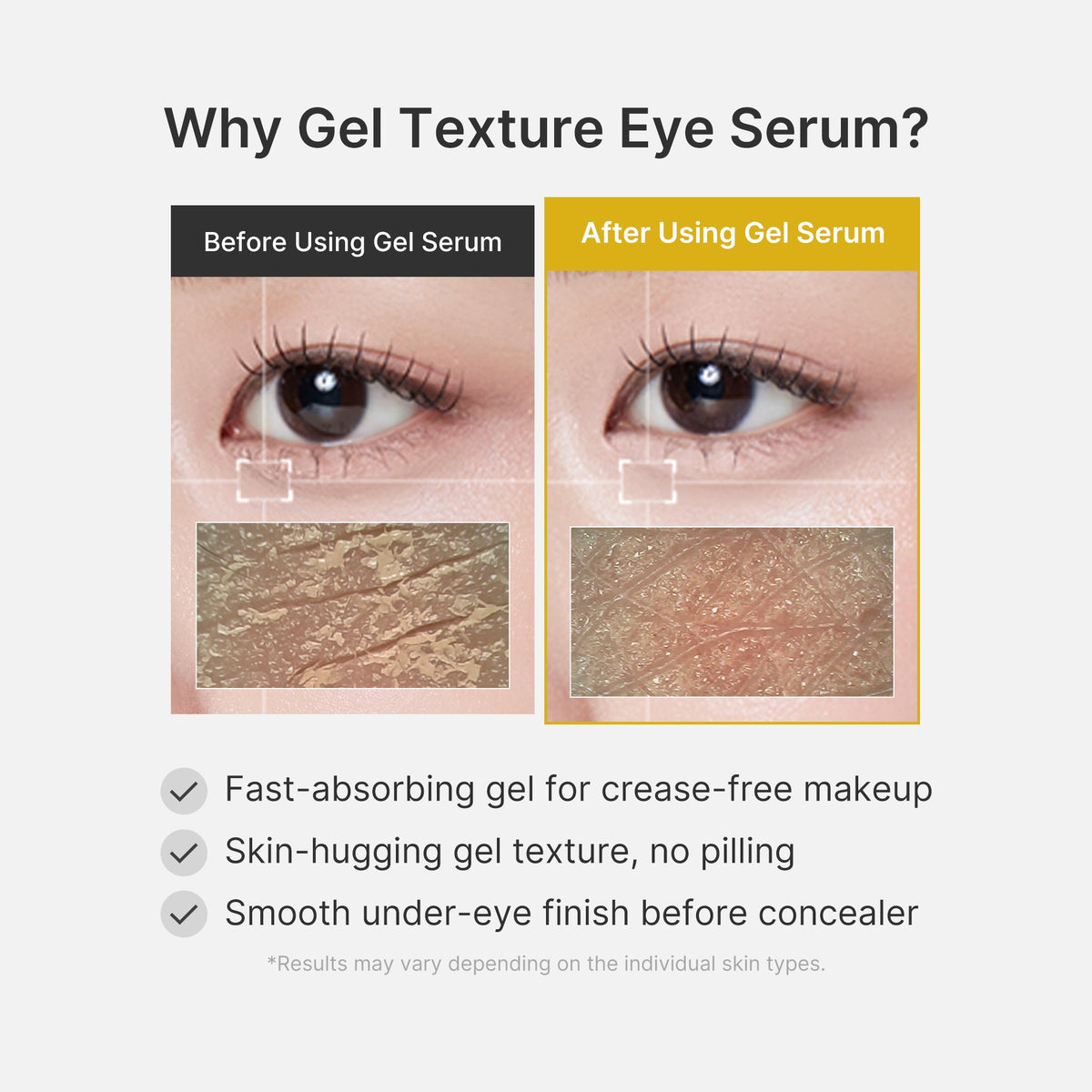 Kojic Acid Tumeric Eye Gel Serum W4