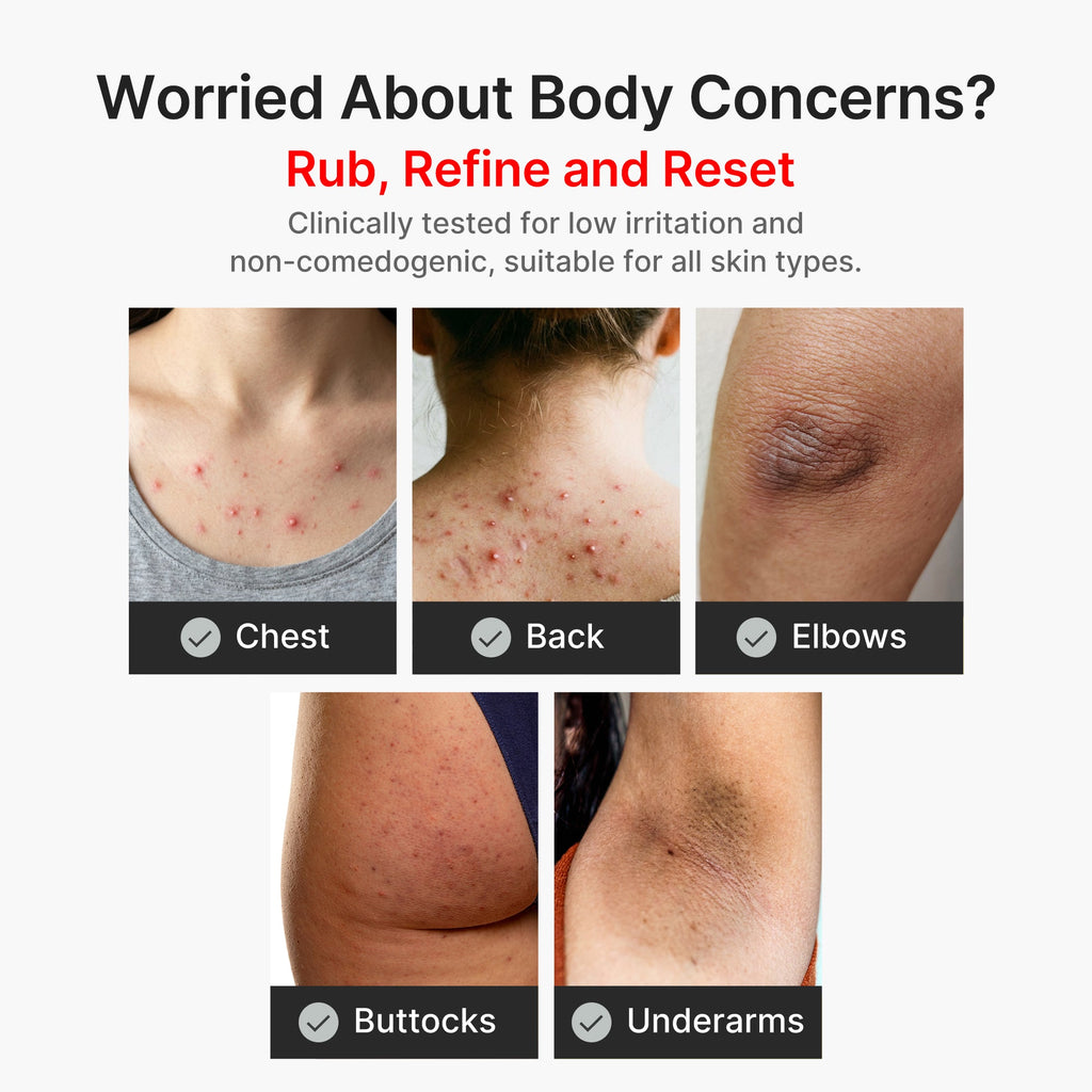 Kojic Acid Turmeric Body Peel Shot T1