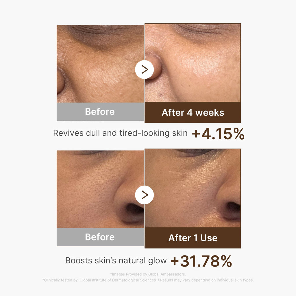 Deep Vitamin C Capsule Serum Q6