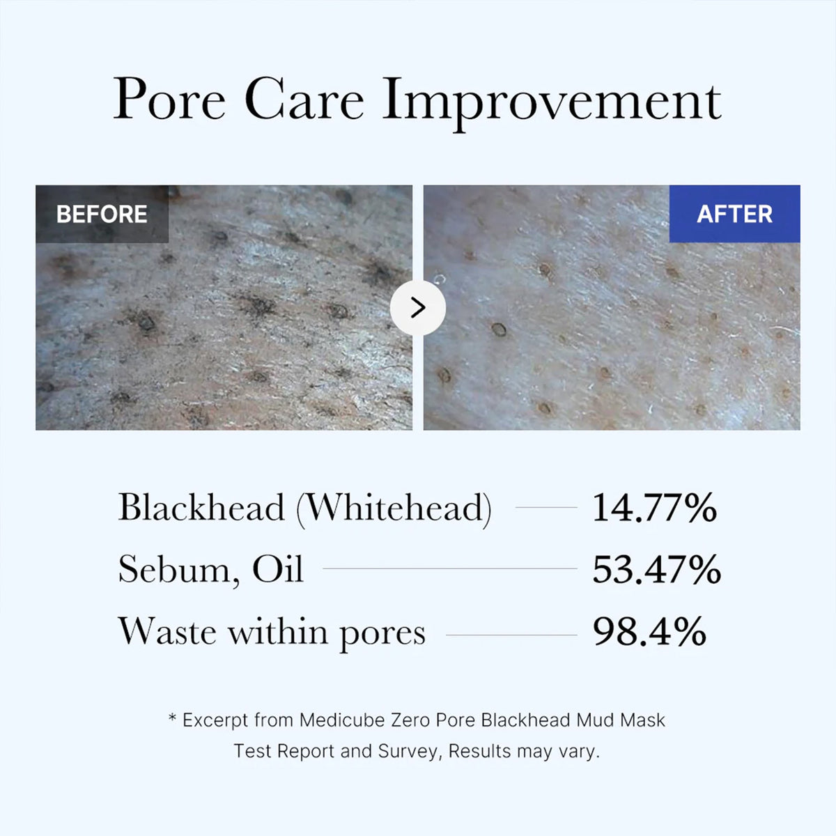 Zero Pore Blackhead Mud Mask T6