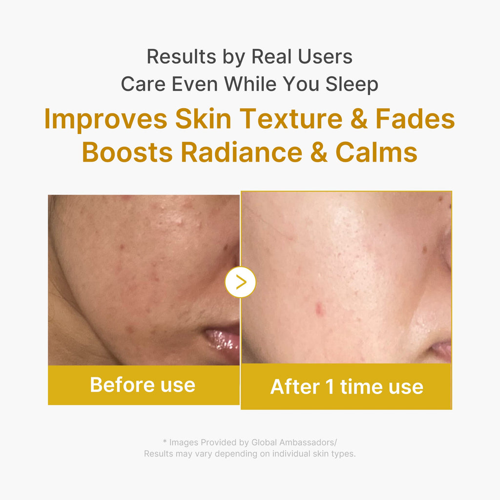 Kojic Acid Turmeric Overnight Wrapping Mask P8