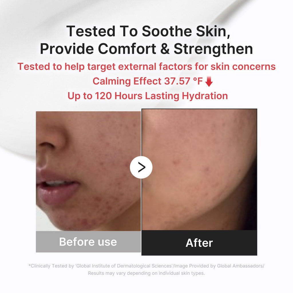 3H Daily Relief Cream M1