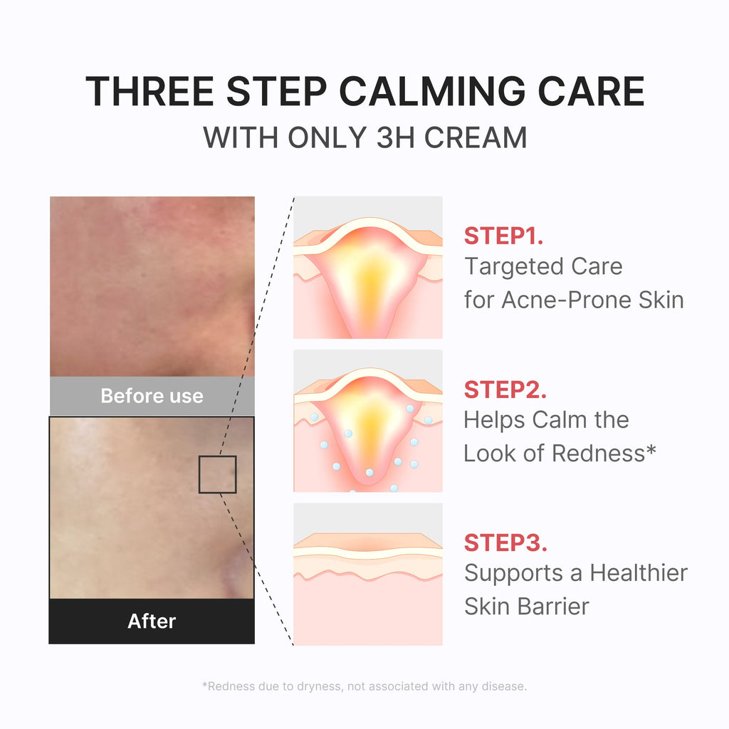 3H Daily Relief Cream M1