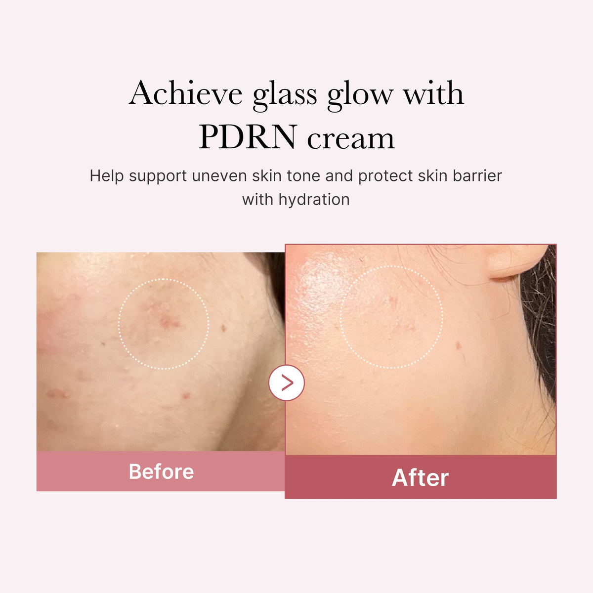 PDRN Pink Peptide Cream E5