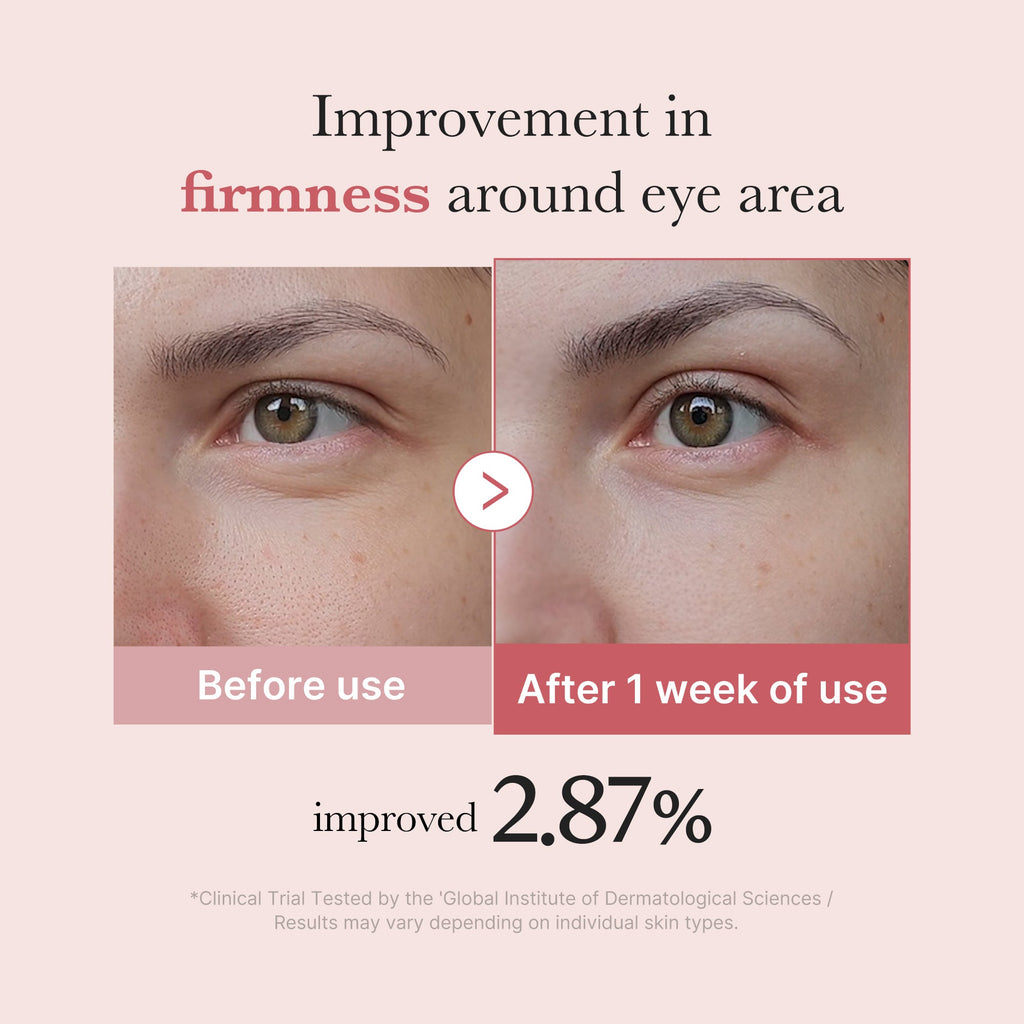 PDRN Pink Peptide Eye Cream Q5