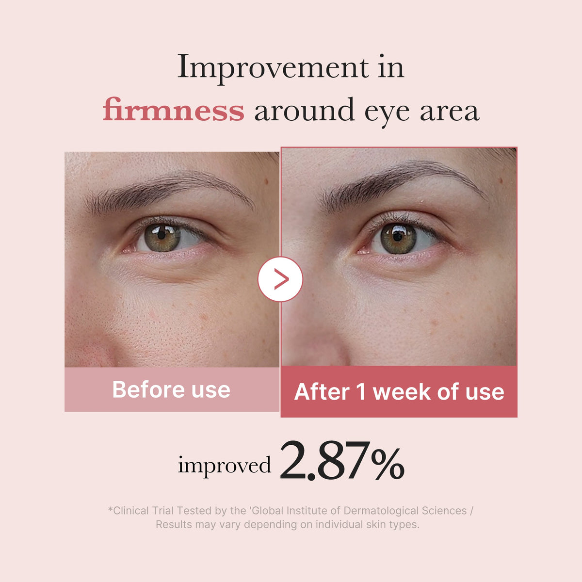 PDRN Pink Peptide Eye Cream Q5