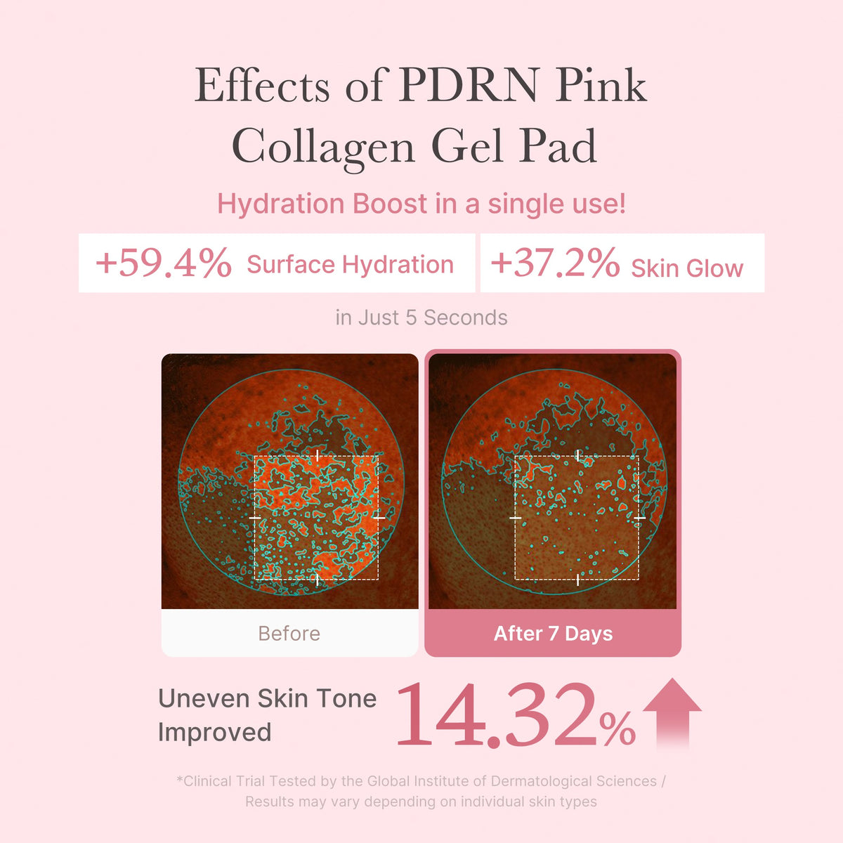 PDRN Pink Collagen Gel Toner Pad P0