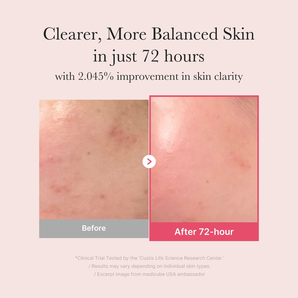 TXA Niacinamide Serum T3